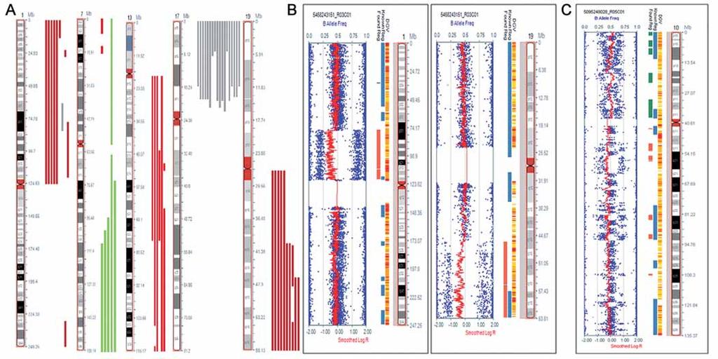 Obr. 1. Chromozomové aberace detekované metodou SNP array. A. Rekurentní aberace na chromozomech 1, 7, 13, 17 a 19 nalezené u pacientů s astrocytomy.