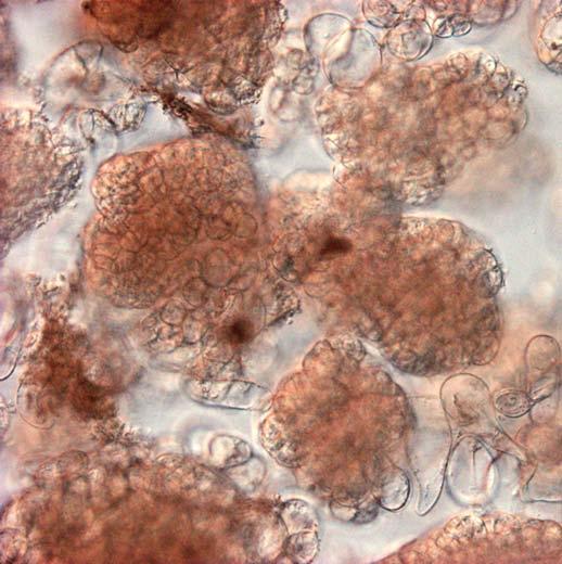 Somatická embryogeneze nepřímá z kalusu