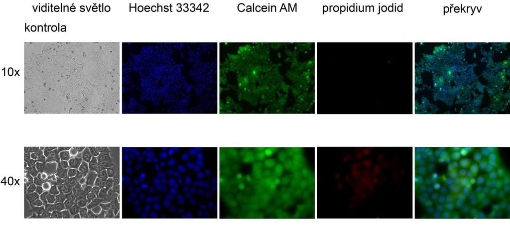 2.5 Stanovení životnosti buněk pomocí Cell Viability Kitu Také pomocí fluorescenční mikroskopie je možné detekovat více parametrů současně.