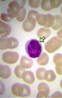 lymfocyty, plazmocyty a