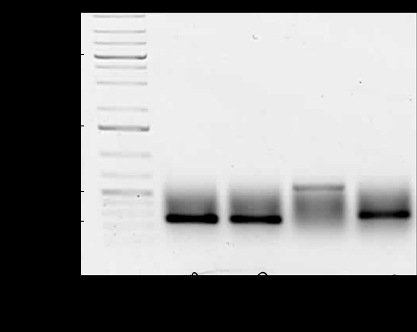 Obr. 26: Elektroforetogram RT-PCR produktů z celkové RNA dvoudenních buněk BY- 2.