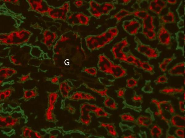 Regenerace ledvin http://www.sciencedaily.