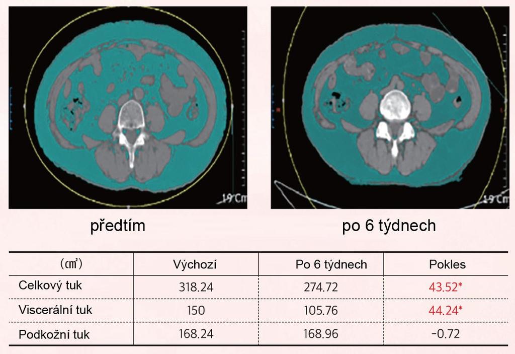 Výsledkem jsou viditelné účinky na úbytek viscerálního tuku - snížení