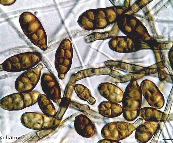3.4.2 Plísně 3.4.2.1 Plísně kontaminující rajčatový kečup Rod Alternaria (čeleď Pleosporaceae) a) b) c) Obr.