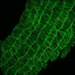 Tvorba fúzního proteinu s GFP -