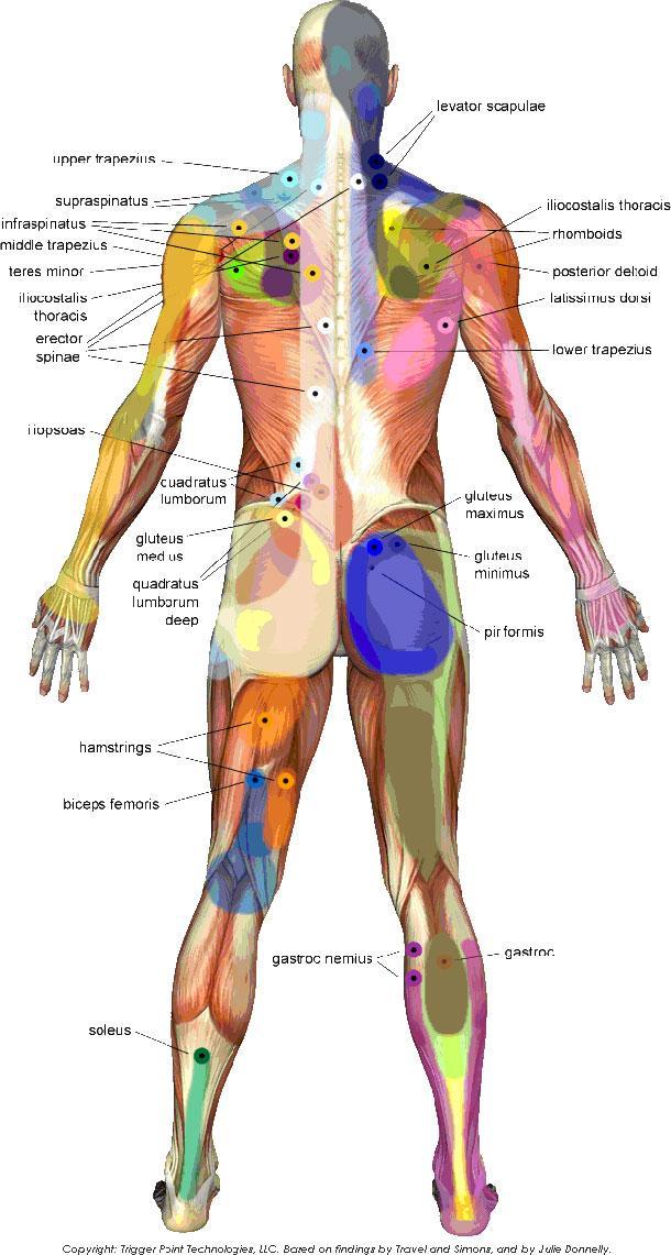 Obr. 5 Spoušťové body a oblasti přenesené