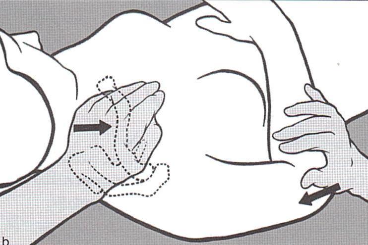 Kraniokaudální pružení akromioklavikulárního kloubu Pacient leží na zádech. Loket na ošetřované straně má v 90 flexi. Stojíme na straně lehátka a fixujeme loket dlaní jedné ruky.