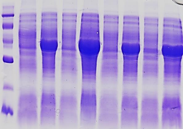 se vztahuje ke kyanidhydratase s velikostí 40 kda a B. k nitrilase s velikostí 36 kda z organismu Aspergillus niger. 5.3. Purifikace proteinů U obou enzymů byla při čištění využita série kapalinových chromatografií.