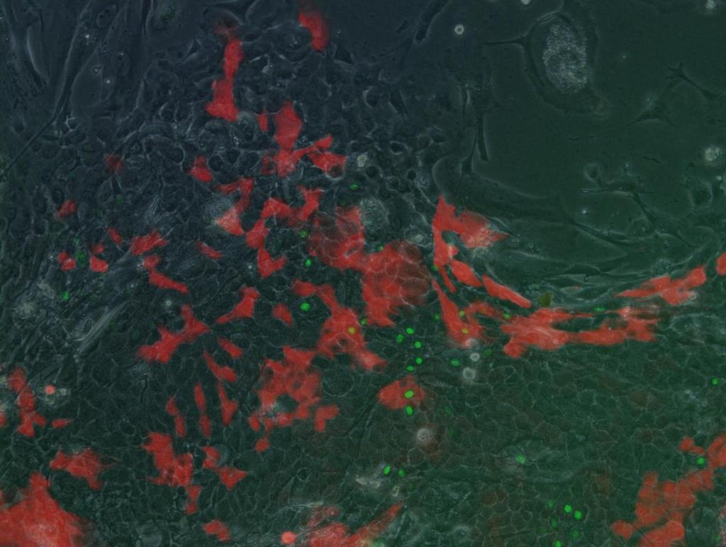6.5 Kulivace in vitro Potomci z křížení ShhCre x R26R-Confetti (stáří 1 a 5 týdnů) byli využiti také ke kultivaci in vitro.