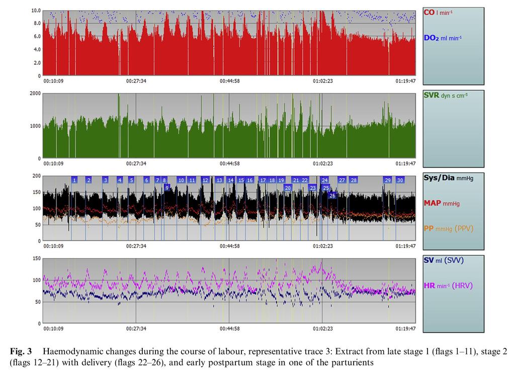 Kuhn. International Journal of