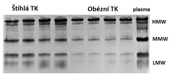 nastavení 0,5 A a za stálého chlazení. Membrány byly poté do provedení imunodetekce zamraženy při -20⁰C.