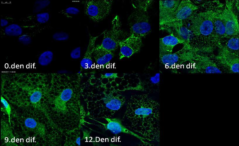 6.5. Profil diferenciace adipocytů pomocí nepřímé imunofluorescence Součástí projektu věnovaného analýze markerů ER v průběhu adipogeneze pomocí nepřímé imunofluorescence byla optimalizace této