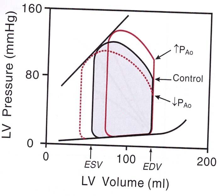 Afterload CO ESV Pokles SV na podkladě zvýšeného