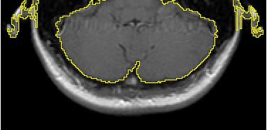 (CT, MRI) ROI