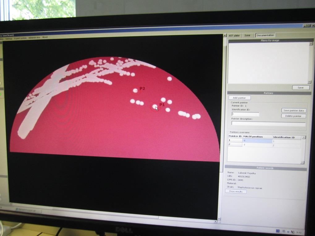 Petriho misky v libovolném pořadí, načtením kódu vyvolá fotografii s koloniemi označenými k