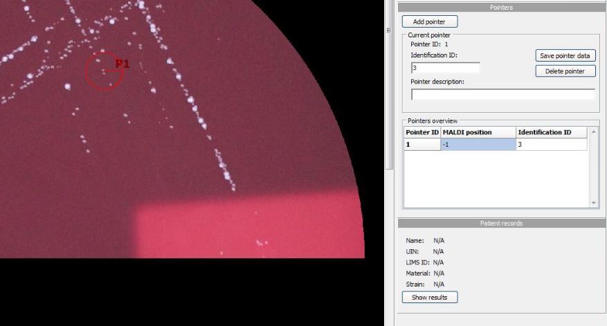 obraz nakultivované Petriho misky, pointry označí kolonie (odpadá problematické popisování misky ze