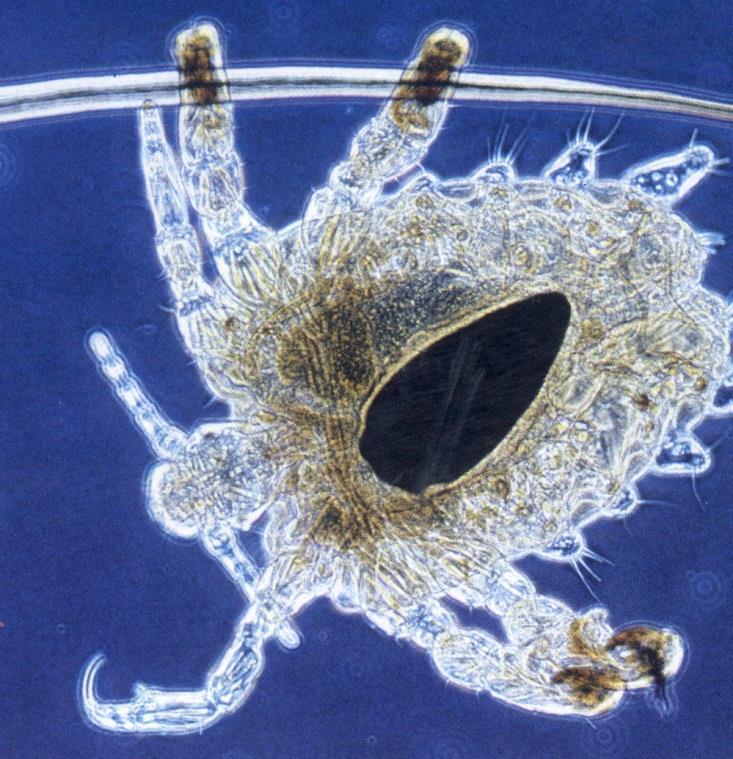 Negativní fázový kontrast - fázová maska zpožďuje fázi nedifraktovaného záření o ¼ vlnové délky Veš muňka (Pthirus pubis) s vajíčkem - interference těchto