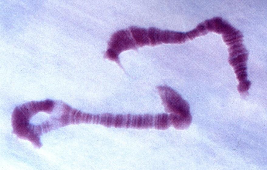 ) Polytenní chromozómy z larev pakomára