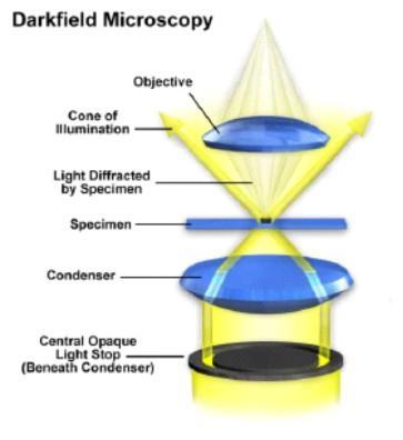 Temné pole - schéma difraktované světelné paprsky 6 6 Davidson and Abramowitz Procházející světlo Zástin Paleček, J. (1996): Biologie buňky, I. Základy mikroskopické cytologie.