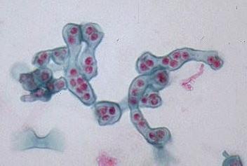 Třída Schizosaccharomycetes: malá skupina (2 rody a 5-6 druhů), jejíţ zástupci se morfologicky podobají pravým kvasinkám, ale znaky na molekulární a biochemické