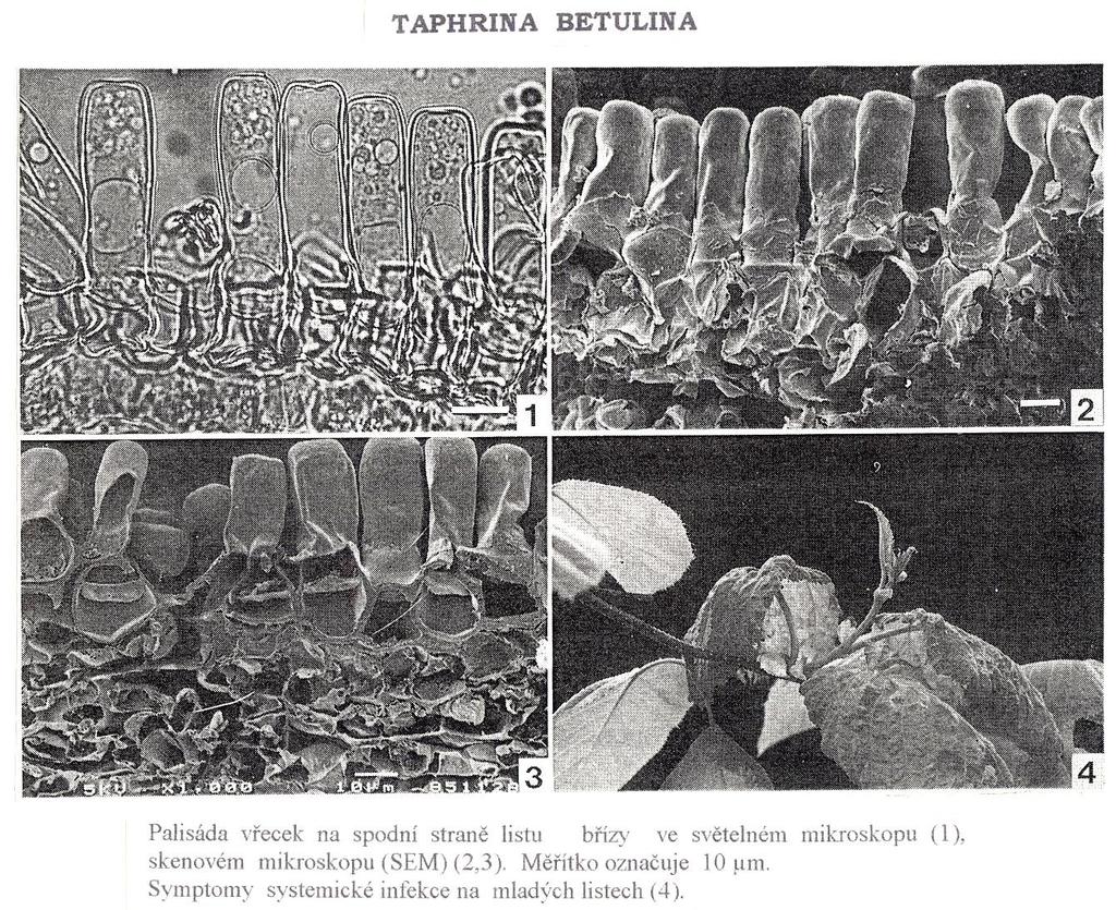 Taphrina betulina - vřecka symptomy napadení Palisáda vřecek na spodní straně