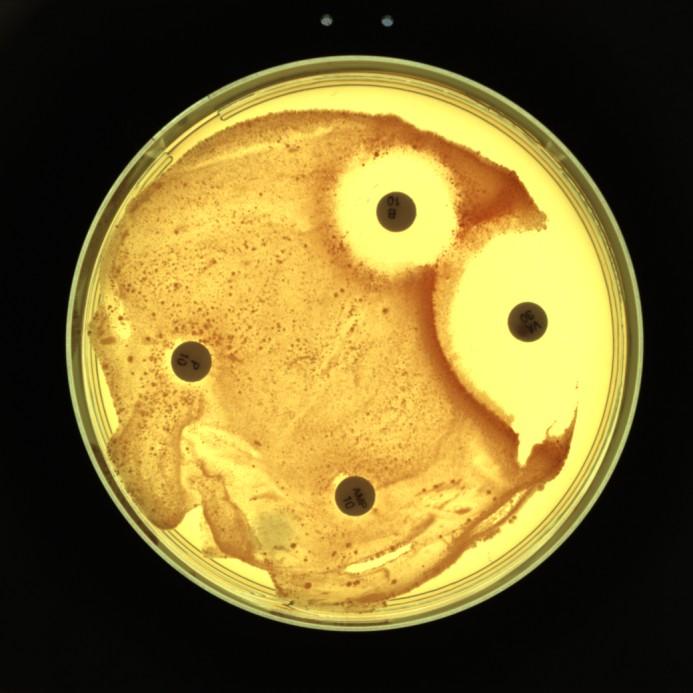 . Obrázek 8: Synergické spolupůsobení tetracyklinu a doxycyklinu na kmen Rhodococcus sp. Obrázek 9: Rezistence na penicillin G a ampicillin u kmene Rhodococcus sp. 5.