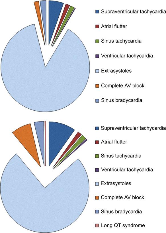 Foetal cardiac arrhythmias D Sedmera et al. Acta Physiol 2015, 213, 303 320 (Stewart et al. 1983, Copel et al. 2000).