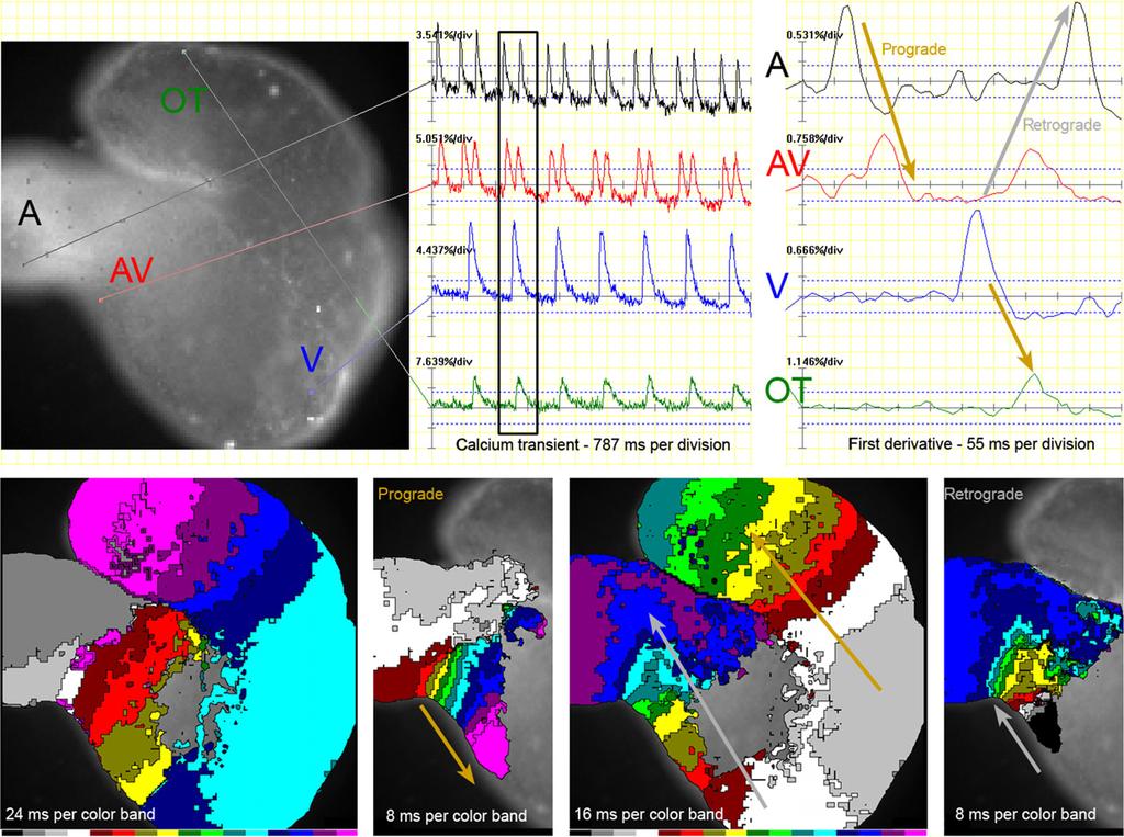 Acta Physiol 2015, 213, 303 320 D Sedmera et al. Foetal cardiac arrhythmias Figure 2 Atrioventricular re-entry in ED4 chick embryonic heart.