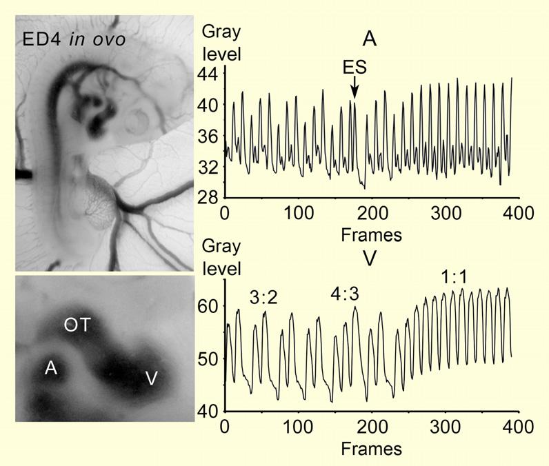 Acta Physiol 2016 F Vostarek et al. Temperature effects on embryonic heart Figure 3 Second-degree atrioventricular (AV) block during hyperthermia in ovo.