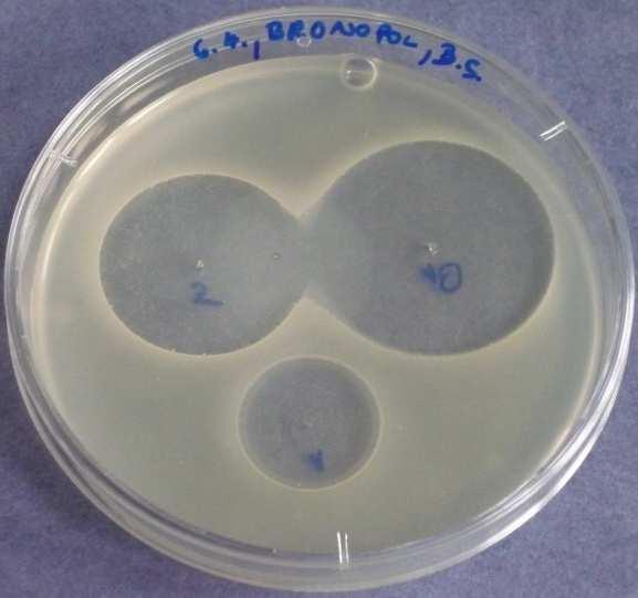 a) b) Obr. 5.16: Bronopol 5. den a) Bacillus subtilis, b) Penicillium chrysogenum Tato konzervační látka se opět ve vyšších koncentracích, než povoluje vyhláška, nesmí používat.