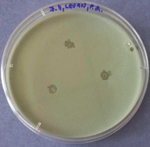 Největšího inhibičního účinku bylo proti Penicillium chrysogenum dosaženo čistou silicí. Inhibiční zóny se však vytvořily i u ředění 1:1 a 1:4.