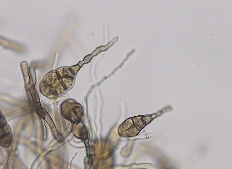 při přídavku této látky do média. Tato konzervační látka je tedy sama o sobě schopná inhibovat Bacillus subtilis již při koncentracích do nejvyššího vyhláškou povoleného množství.