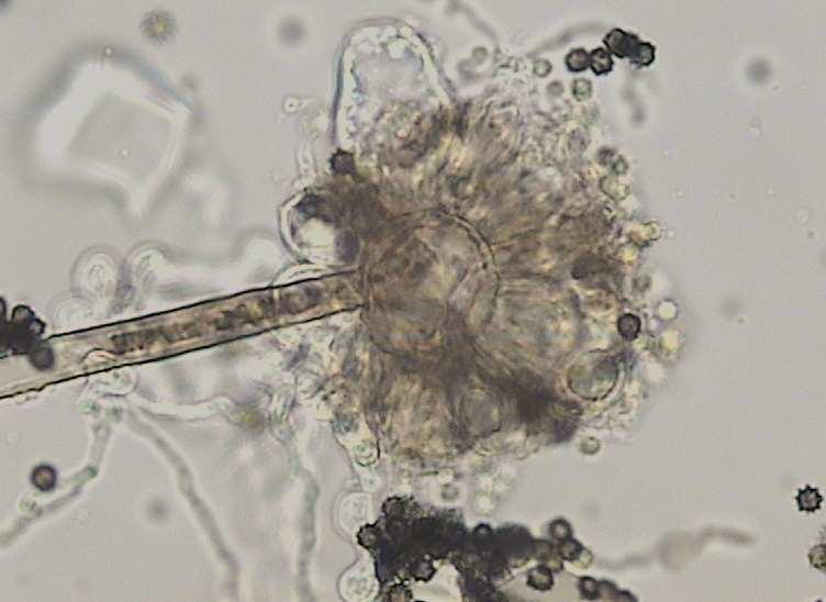 Biverticillata symmetrica Asymmetrica Polyverticillata Plíseň rodu Aspergillus Další identifikovanou plísní byla plíseň zařazená k rodu Aspergillus (Obr. 5.39).