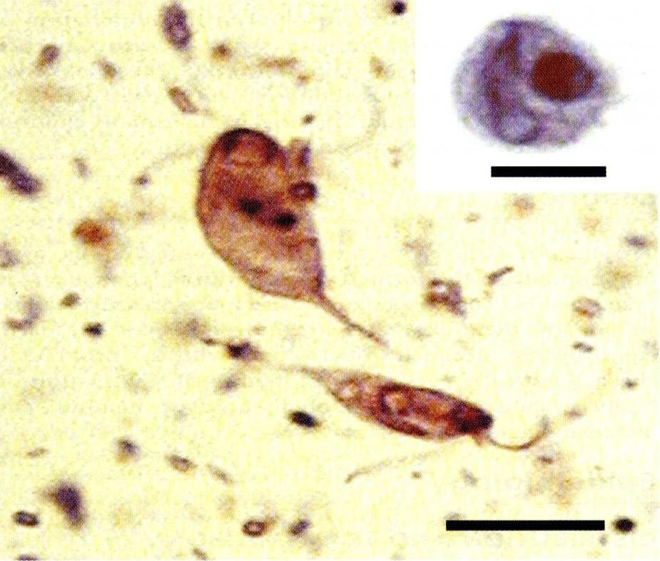 Které druhy nepatogenních střevních protozoí známe?