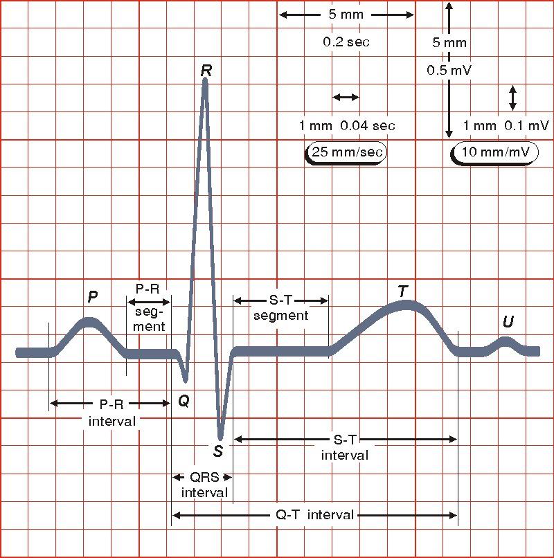 2: 2: EKG křivka zdravého dospělého člověka [16] Z obrázku je patrné, že signál se vyznačuje typickými vlnami a kmity, které odpovídají
