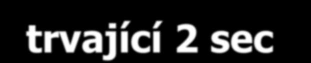 KPR novorozence Při apnoi nebo poruše dýchání během 1 min.