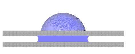(2/R) + (2cos/d) Scheme of Laplace pressure s actions inside a liquid body penetrating into the radial capillary leading to a condition of spontaneous penetration of liquid drop into the radial