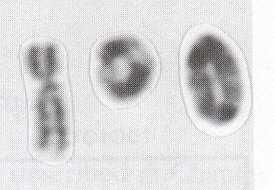 spojení acentrické ringy jsou bez centromery, kruhové chromosomy zahrnují centromeru Obr.