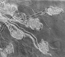 zabývající se asociací stejných partnerů (Chambers et al. 1999), prokázala výskyt R. ericae i v rhizoidech antarktických játrovek. Obr. 7: Rhizoidy játrovky Cephalozia connivens kolonizované R.