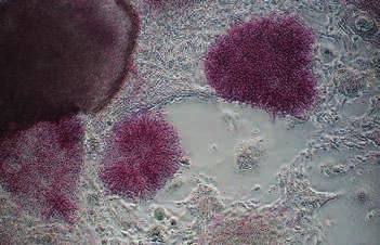 buněčného růstu s onkogenním potenciálem. Při reprogramování lidských somatických buněk proto byly nahrazeny faktory Lin28 a Nanog.