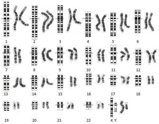 Skupina D střední akrocentrické chromosomy 13, 14, 15 Skupina E malé submetacentrické chromosomy 16, 17, 18 Skupina F malé metacentrické chromosomy 19, 20 Skupina G malé akrocentrické chromosomy 21,