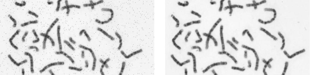3 ZPRACOVÁNÍ OBRAZOVÝCH SNÍMKŮ S vývojem cytogenetických metod se zvyšují i nároky na rychlost automatické analýzy cytogenetických obrazů.