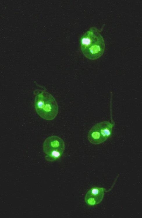 Autoprotilátky proti dvojspirálové DNA (a-dsdna) ANA homogenní fluorescence jader na HEP 2 bb Specifickým