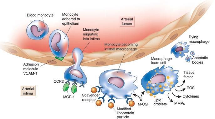 6.4 Apoptóza makrofágů Pohlcením oxidovaných lipidů může dojít k apoptóze makrofágů, což může vést v časných stádiích aterosklerózy k redukci progrese (35).