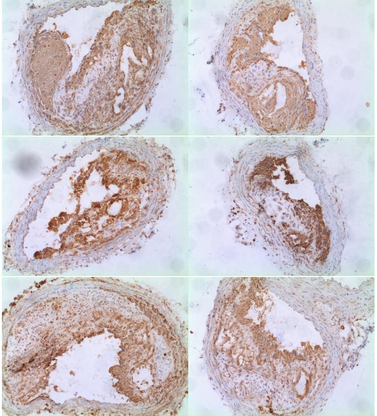 Obrázek 7: Reprezentativní obrázky imunohistochemického barvení makrofágů u LCHP skupiny zvířat.