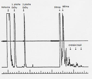 K zpoždění výsledků dochází při onemocnění zrakového nervu. K prodloužení latence vlny P100 dochází u neuritid optiku, kdy dochází k demyelinizaci gangliových buněk a tedy i zrakového nervu.