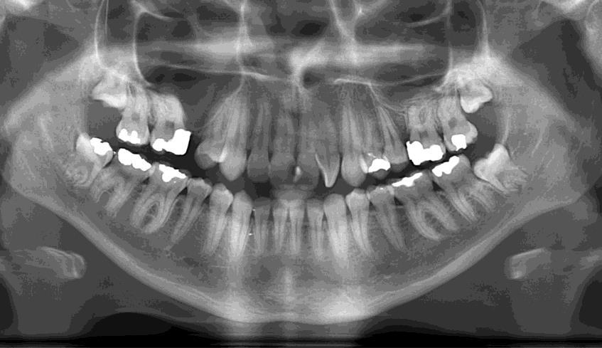II. Praktická část 1. Vyhodnocení CARIOGRAMU komplexní testování rizik Jméno a příjmení: XY Datum narození: 2. 7.