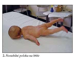 vývoji