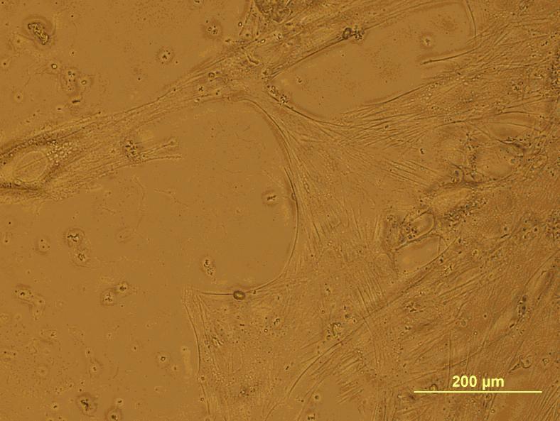 považovat za přímého ukazatele počtu buněk. Z tohoto důvodu byla metoda MTT kombinována s metodou PicoGreen, která využívá fluorescenčního barvení DNA a umožňuje kvantifikovat množství DNA na nosiči.