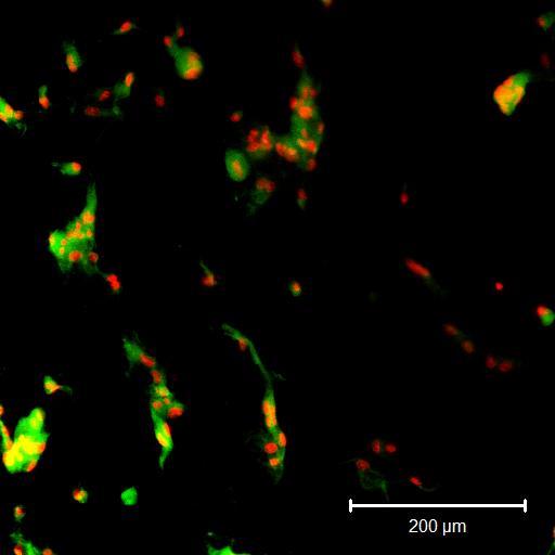 Obr. 19: Mezenchymální kmenové buňky na modifikovaném nosiči. Snímek z konfokální mikroskopie ukazuje, že dochází k adhezi buněk na modifikovaný nosič.